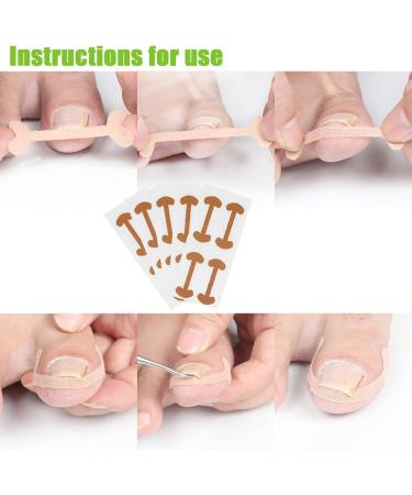 Braleto Toenail Clippers Set Manicure Tools Set for Thick Nails Stainless Steel Toenail Cutters Nail File Ingrown nail pliers Gel Big Toe Cap toenail corrector strips for Ingrown Toenail Treatment - Buy Online on GoSupps.com