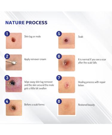 Mole Removal & Skin Tag Repair Gel Set - Remove Effectively at Home - Buy Online on GoSupps.com
