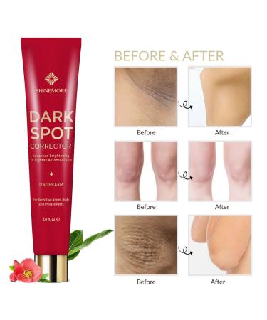 Intimate Dark Spot Corrector Cream - Instant Results for Underarms, Knees, Elbows - All-Natural - Buy Online on GoSupps.com