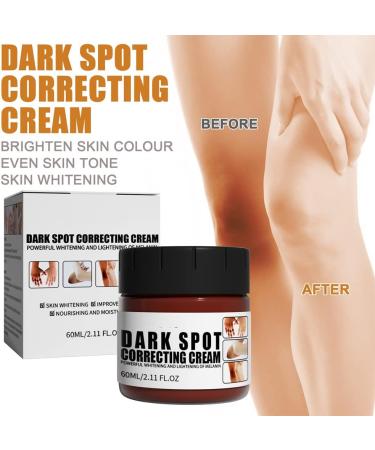60g Bigsaleusa Dark Skin Bleaching Cream Whitening Cream for Dark Skin Brightening Gel for Knee Joints (2PCS) - Buy Online on GoSupps.com