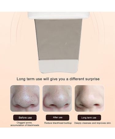 Face Skin Spatula - Blackhead Remover & Pore Washing Tool with LED Display - Buy Online on GoSupps.com