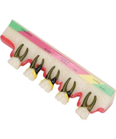 Shop Verdant Touch Tooth Model - Dental Periodontal Disease Study Tool for Schools | International Shipping Available - Buy Online on GoSupps.com