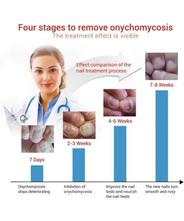 Nail Repair Natural Nail Care Maximum Strength Nail Solution Restores Discolored & Damaged Nails Nail Care Solution - Buy Online on GoSupps.com