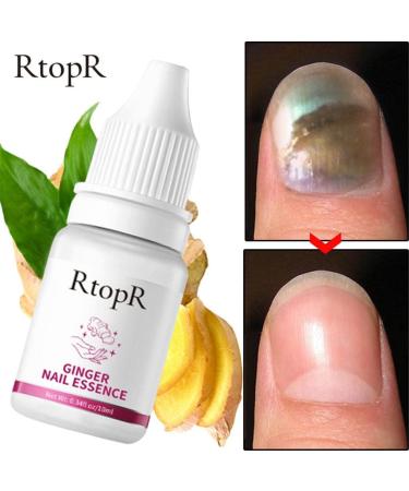 Nail Nail Toe 10ml Nail Drill for Gel Nails (multicolor One Size) 1 ml (Pack of 1) Multicolor - Buy Online on GoSupps.com
