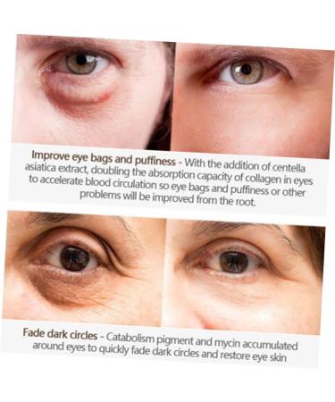  FOYTOKI Eye Contour Cream for Wrinkles Alligator Essence Dark Circle Remover Puffiness Anti-aging Moisturizing Cream - Buy Online on GoSupps.com