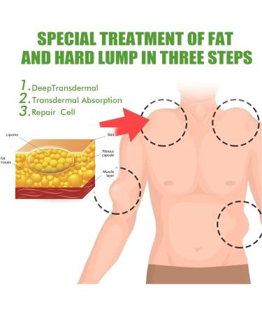 Delipidation Cream for Lipoma Removal and Anti-Swelling - Cellulite Ointment for Lipoma Lumps - Buy Online on GoSupps.com