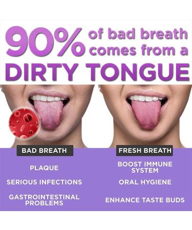 Stainless Steel Tongue Scraper for Fresh Breath and Restored Taste - U-Shape Design - Buy Online on GoSupps.com