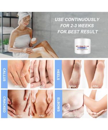  ACWOO ACWOO Uree Cream 42% plus Acid 2% 150 g Urea Moisturizing Repair Foot Cream Dry and Cracked Foot Cream Crevice Foot Cream with Urea For Very Dry Feet Damaged Feet - Buy Online on GoSupps.com