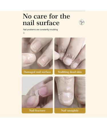Huile durcissante pour ongles | Huile pour cuticules pour une croissance et un renforcement rapides des ongles P n tration rapide et facile d'entretien avec effet de renforcement naturel pour les - Buy Online on GoSupps.com