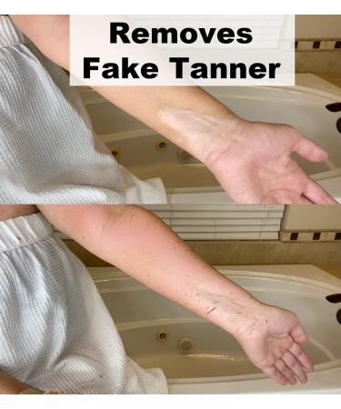 SILK Exfoliating Glove: Deep Exfoliation for Smooth Skin and Keratosis Pilaris Removal - Buy Online on GoSupps.com