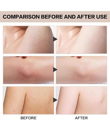 Quarxery Exfoliating Gel Scrub & Peeling Cream - Deep Cleansing & Moisturizing for All Skin Types - 2PC - Buy Online on GoSupps.com