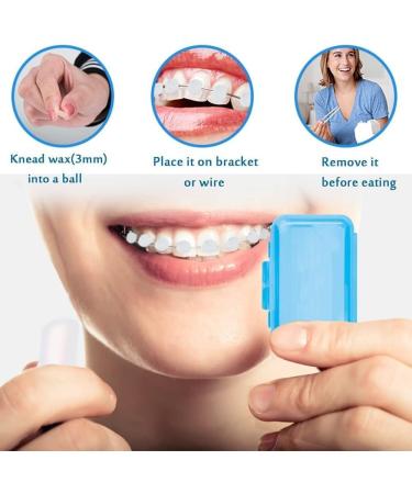 10 PCs Orthodontic Tooth Wax Strips - Relief for Braces & Aligners | 10 Color Options for Tooth Protection - Buy Online on GoSupps.com