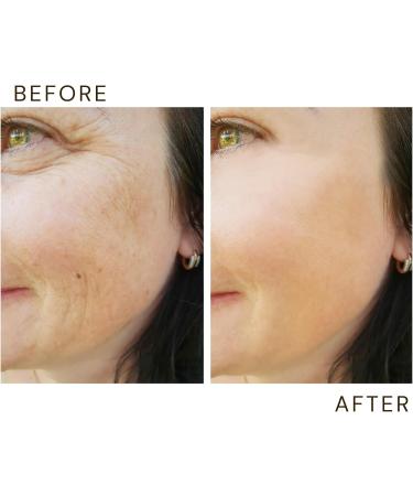 Anti Ageing Toner - Organic Facial Lotion | Repairs Skin Fine Lines Wrinkles Reduce Dirk Circles with Multivitamin Formula - Hydrating Toning Lotion | 200ml - Buy Online on GoSupps.com