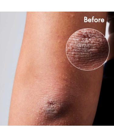 Lanolips 101 Dry Skin Super Cream - Hydrating Whipped Body Cream for Face + Body - Triple Lanolin, Almond Oil, Shea Butter & Vitamin E - 2.02 oz - Clean, Cruelty-Free - Buy Online on GoSupps.com