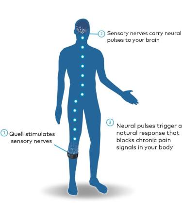 Quell 1.0 Pain Relief Technology 2016 Black - Fast Relief for Chronic Pain - Buy Online on GoSupps.com