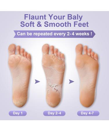 Funnir Foot Peel Mask - Natural Exfoliant for Callus Removal & Repair | Softens Rough Heels & Smoothens Dry Skin - 5 Pairs - Buy Online on GoSupps.com