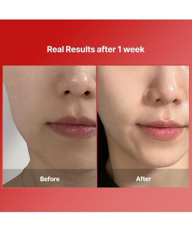 Buy MEDITHERAPY Shumage Gold Seal Wrapping Mask - 82.5% Collagen Overnight Peel Off Mask for Revitalizing & Tightening | Korean Skin Care | International Shipping - Buy Online on GoSupps.com