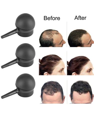 Hair Fiber Spray Applicator Pump Nozzle for Thinning Hair | Enhance Volume for Men & Women - Buy Online on GoSupps.com