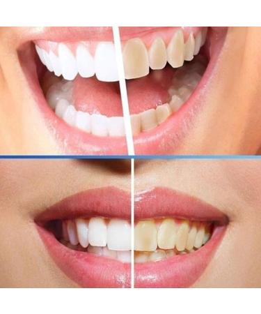 Miyanxi Tooth Powder - Effective Whitening for Coffee & Smoke Stains | 50g Box | International Shipping - Buy Online on GoSupps.com
