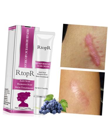 PLAFOPE Scar Cream - Scar Eraser & Remover for Face, Stretch Marks, Skin Repair - 1pc - Buy Online on GoSupps.com