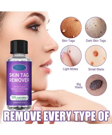 LDREAMAM Skin Tag Removal Gel - Safe & Effective Mole & Wart Remover - Buy Online on GoSupps.com