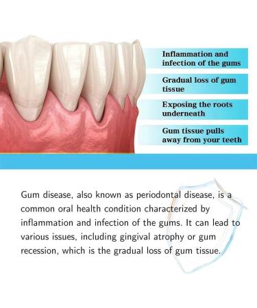 Advanced 30 ml Gum Repair & Regrowth Drops - Natural Oral Care Liquid for Rejuvenation | 3 Pieces - Buy Online on GoSupps.com