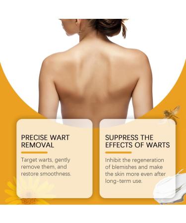PAZRSASX Anti-wart Skin Care Cream Remove Skin from Warts with Nutmeg Lock in Moisture and Lighten Skin - Buy Online on GoSupps.com