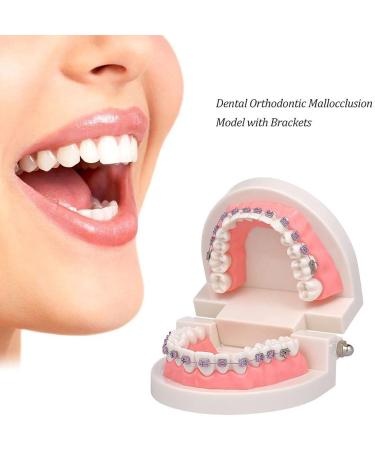 Dytah Orthodontic Demonstration Model - Teeth Study Model with Metal Arch Wire & Brackets for Effective Teaching - Buy Online on GoSupps.com