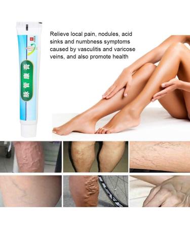 Varicose Veins Cream & Ointment for Relief | Phlebitis Angiitis & Inflammation Treatment - Buy Online on GoSupps.com