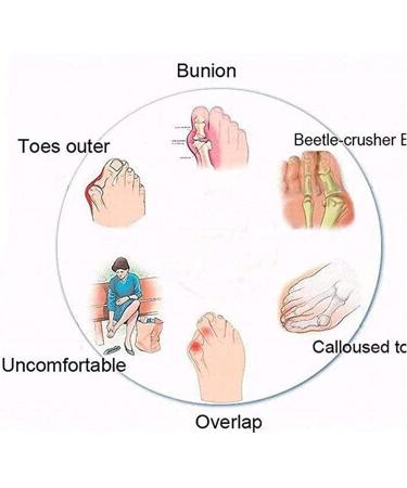 Women s Bunion Correcting Sandals - Orthopedic Comfortable Summer Beach Slippers - Open Toe Non-Slip - US Size 9.5 & 10 - Buy Online on GoSupps.com
