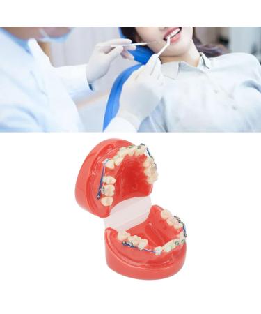 Buy GFRGFH Dental Model with 24 Teeth - Half Metal Half Ceramic Bracket for Teaching & Study - International Shipping Available - Buy Online on GoSupps.com