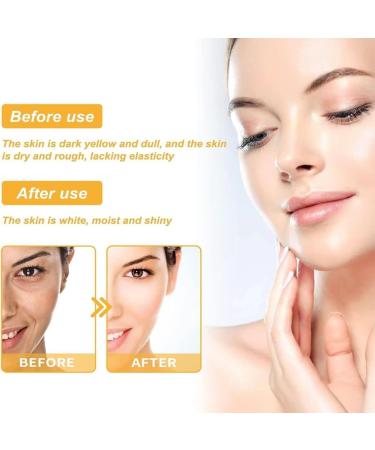 Juelreou Freckle Removal Mask | 2024 Anti-Blemish Anti-Aging & Anti-Wrinkle Tear-Off Mask | Beautykomi Skin Rejuvenation Sleep Facial (6pc - Buy Online on GoSupps.com