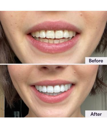 Smirk Teeth Brightening Powder 40g - Natural Whitening Formula | Shop Now - Buy Online on GoSupps.com