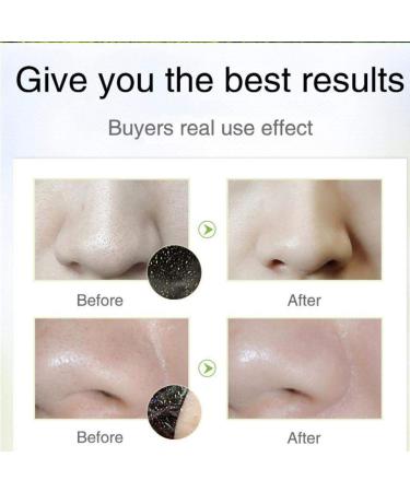 Deep Cleansing Blackhead Removal Bamboo Facial Mask | Purifying Peel Off Mud Treatment - Buy Online on GoSupps.com