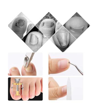 Ruiqas 5Pcs Stainless Steel Nail Cutter Set | Manicure Scissors Nail Picker & Ingrown Nail Corrector - International Shipping - Buy Online on GoSupps.com