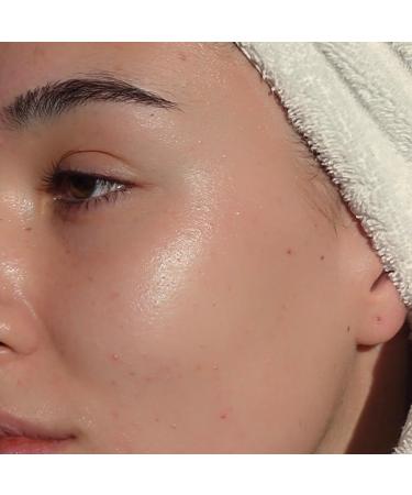 Lumene Nordic Hydra Lahde Moisture Balm - Lightweight Face Cream + Dry Skin Hydrating Balm - Organic Nordic Birch Sap Arctic Spring Water & Plumping Hyaluronic Acid (1.7 oz) - Buy Online on GoSupps.com