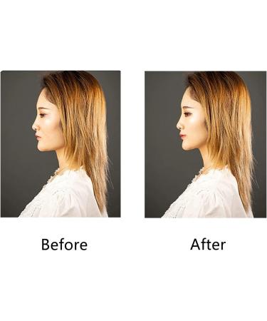 DDHHQ Foxy Eyes Lift - Reusable Facelift Bands with Clips for Instant Eye Lift (Black) | International Shipping Available - Buy Online on GoSupps.com