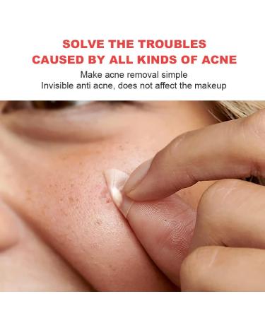 Buy Hydrocolloid Pimple Patches - Acne & Blemish Covers for Clear Skin | International Shipping Available - Buy Online on GoSupps.com