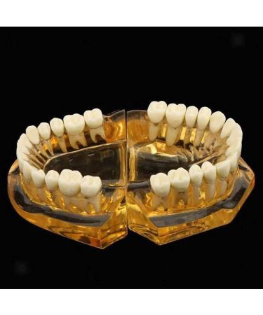 LBYLYH Adult Tooth Replica Model - Medical Dental Teaching Tool for Professionals - International Shipping Available - Buy Online on GoSupps.com