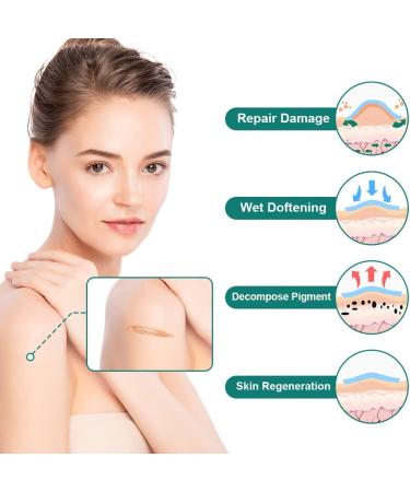 ACWOO Silicone Scar Sheets (1.6 x 120 3M) - Professional Reusable Soft Silicone Tape for Scar Removal - Ideal for C-Section, Surgery, Burn, Keloid, Acne - Painless Treatment for New & Old Scars - Buy Online on GoSupps.com