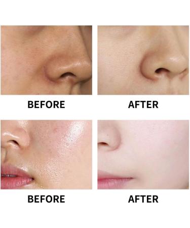 Pore Refiner 30ml | Pore Reducing Tightening Cream | Smoothes and Refines Skin Texture | Refines and Smoothes Skin Texture Unclogs Pores Combination Oily or Blemish-Prone Skin (90ml) - Buy Online on GoSupps.com