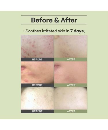 Green Salvia Calming Ampoule - Hydrating Vegan Serum for Oily Skin Soothes Redness & Irritation 50ml - Cruelty Free Korean Moisturizer - Buy Online on GoSupps.com
