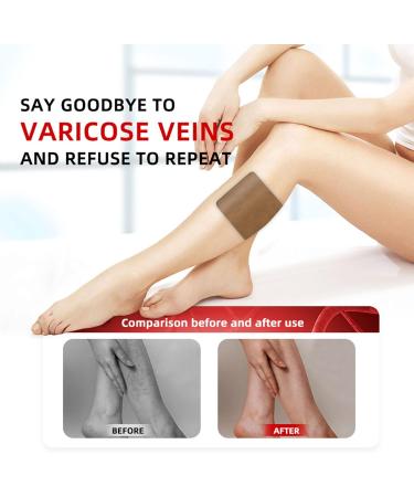 Spider Vein Plaster 30ct | Varicose Vein & Phlebitis Care | Leg Vein Removal Treatment - Buy Online on GoSupps.com