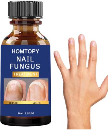 Durcisseur et fortifiant pour Ongles | Mycoses Solution Extra Forte pour Les Ongles - Patchs pour Ongles Anti-fongiques pour Le renouvellement des Ongles Force maximale pour Les - Buy Online on GoSupps.com