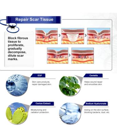 Lavender Scar Removal Serum for Stretch Marks & Skin Repair - Brightening Treatment Liquid - Buy Online on GoSupps.com