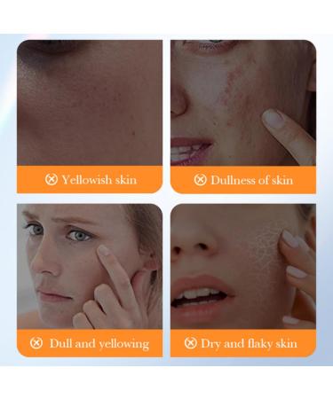 Whitening Niacinamide Serum - Face Serum for Women - Hyaluronic Acid Serum for Face - Skin Care for Dark Spot Correcting Glow Serum - Face Serum for Anti-Ageing and Wrinkles (30ml) - Buy Online on GoSupps.com