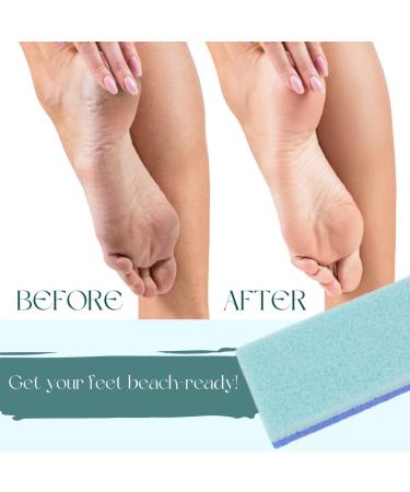 Mantello Foot Scrubber Pumice Stone 4 Pack - Double Sided Dead Skin Remover for Shower and Foot Tub - Pedicure Supplies Feet Scrubber - Buy Online on GoSupps.com