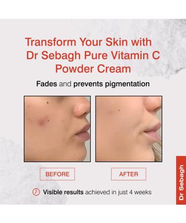 Dr Sebagh - Vitamin C Powder Cream CLINICALLY PROVEN RADIANCE - Vitamin C Cream for Face - Glow Boosting Skincare - Vitamin C Cream for Dark Spots Eye Face & Acne - (0.07 Oz 1 Pack) - Buy Online on GoSupps.com