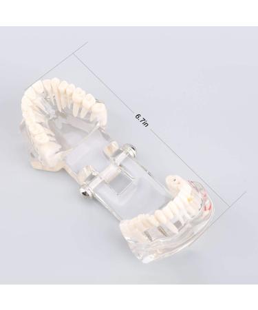 Teeth Model for Dental Teaching & Research | Realistic Adult Teeth Demonstration | No Brand - Buy Online on GoSupps.com