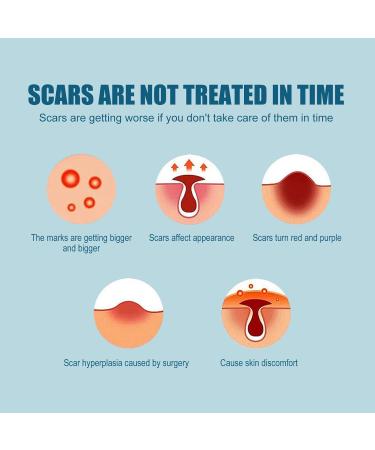 Scar Repairing Serum 30ml - Gentle Scar Removal for All Skin Types - Buy Online on GoSupps.com